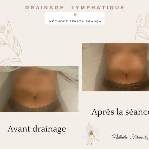 photo d'un ventre avant et après un drainage lymphatique